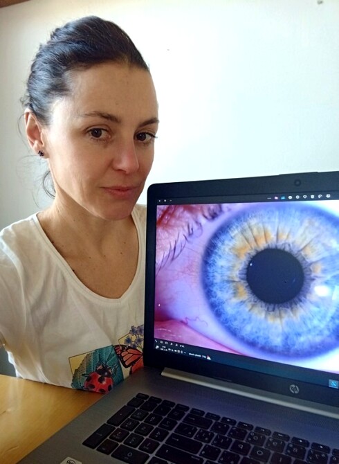 Irisdiagnostika Diagnostika z dúhovky oka